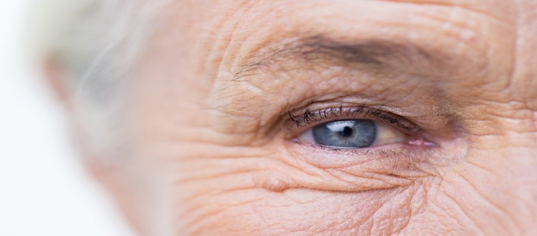 7 Ways To Beat Wrinkles