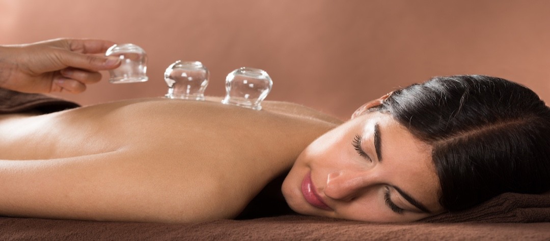 Guide To Cupping