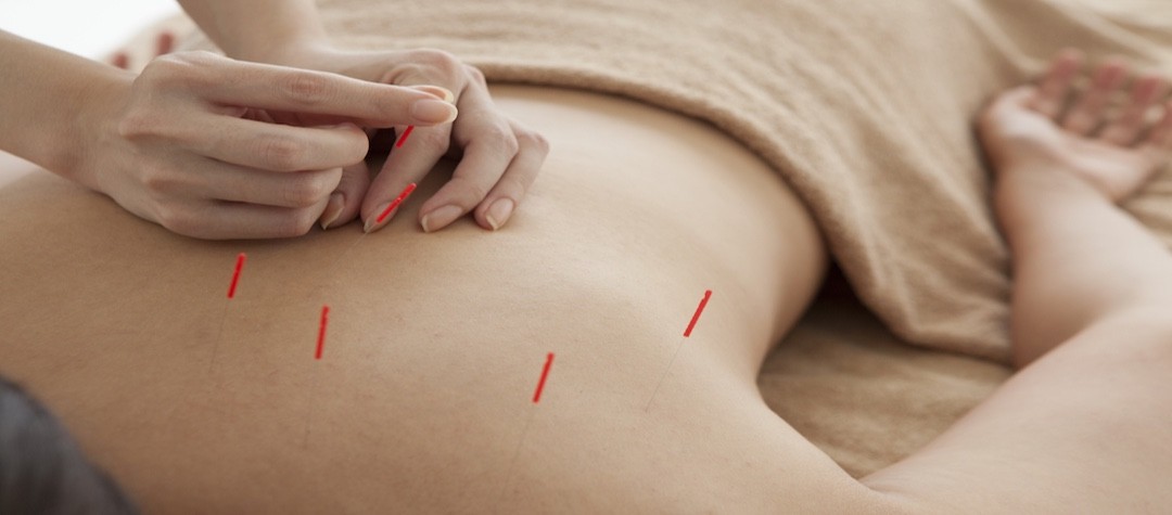 Guide To Acupuncture