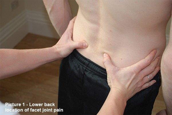 Lower back location of facet joint pain Lower back location of facet joint pain